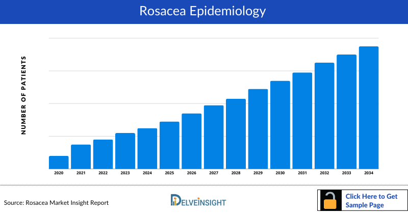 Rosacea Epidemiology